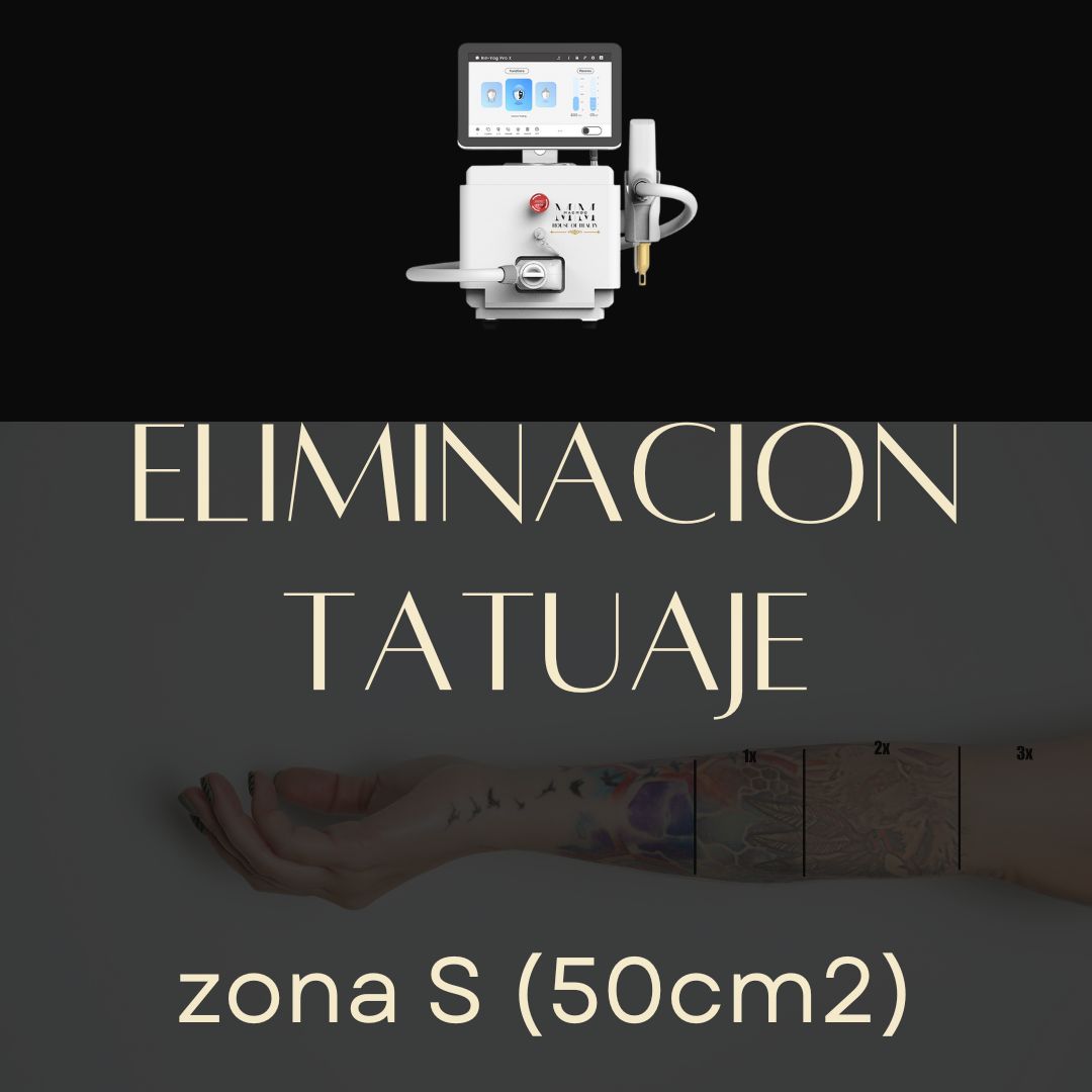 Eliminación de tatuajes S